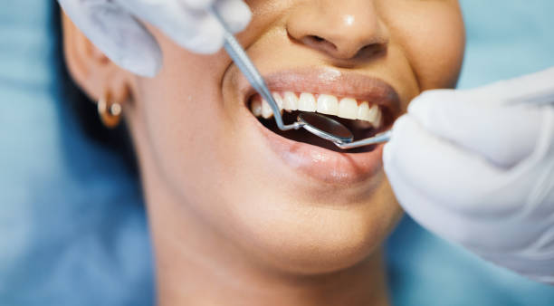 Best Weekend Emergency Dental Services in Port Ludlow, WA